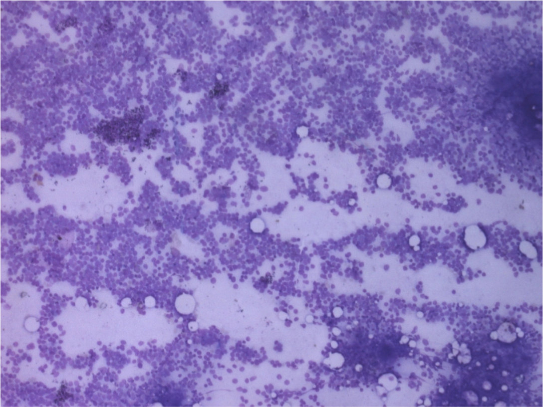 BM smear